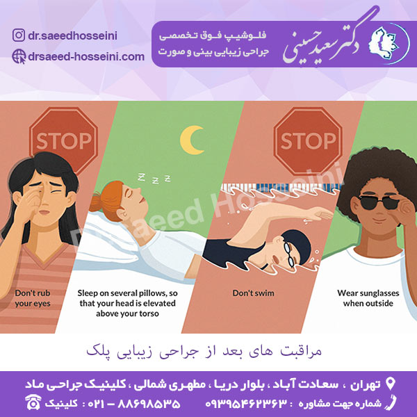 مراقبت های بعد از جراحی زیبایی پلک