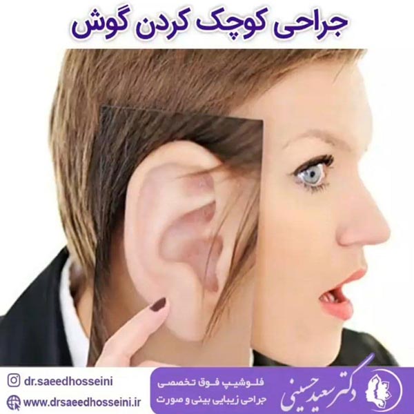 جراحی زیبایی گوش