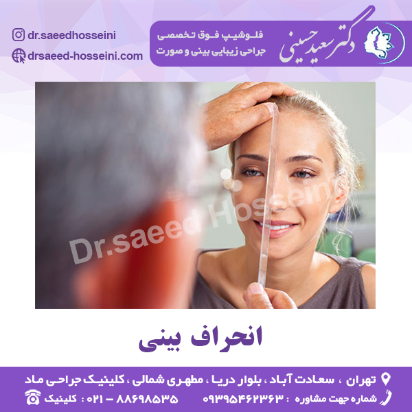 انحراف بینی