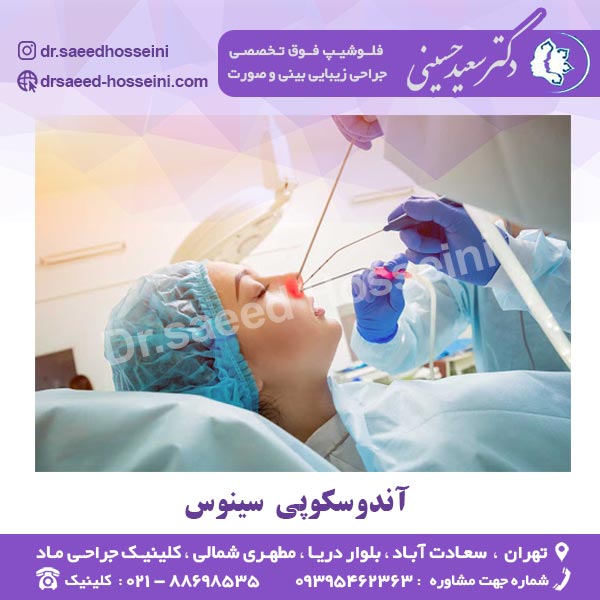 آندوسکوپی سینوس