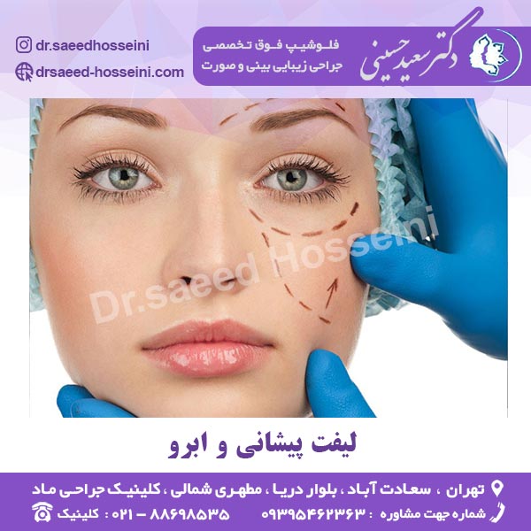 لیفت پیشانی و ابرو