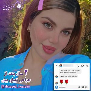 جراحی بینی - دکتر سعید حسینی 