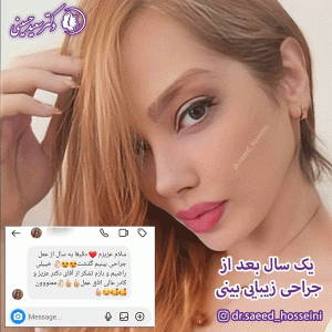 جراحی بینی - دکتر سعید حسینی 