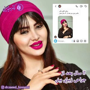 جراحی بینی - دکتر سعید حسینی 