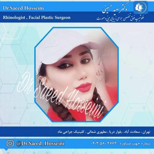 جراحی-بینی-251 (1)