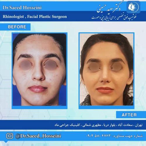 جراحی-بینی-255 (1)