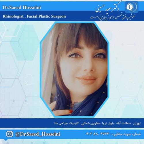 جراحی-بینی-327 (1)