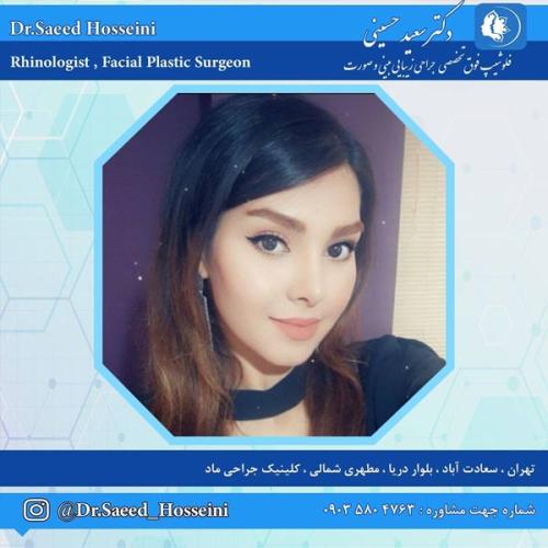 جراحی-بینی-328