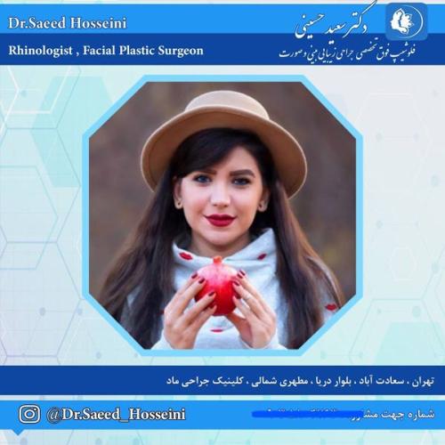 جراحی-بینی-330