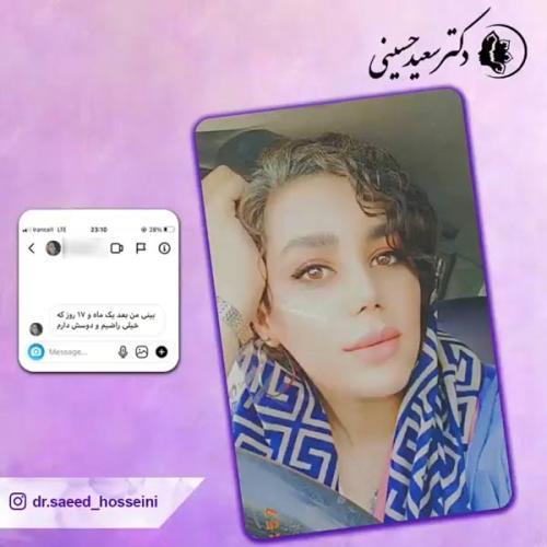 جراحی-بینی-333