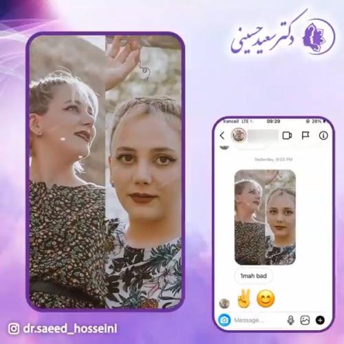 جراحی-بینی-335