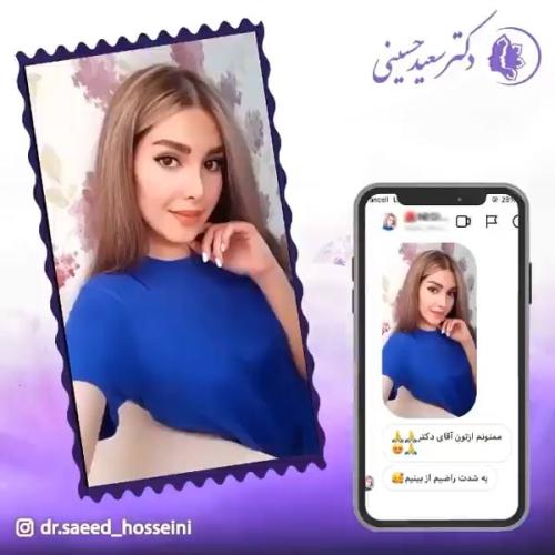 جراحی-بینی-336