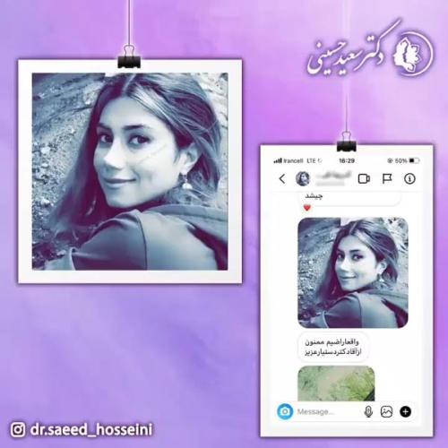 جراحی-بینی-339