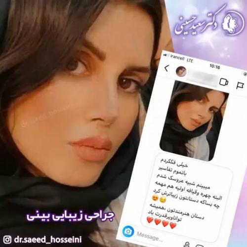 جراحی-بینی-348