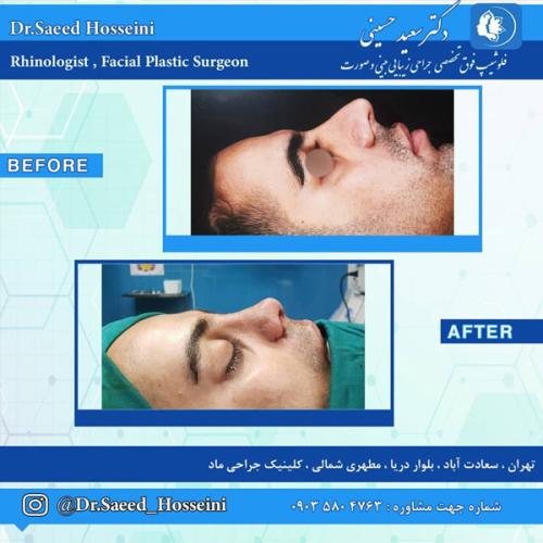 جراحی-بینی284