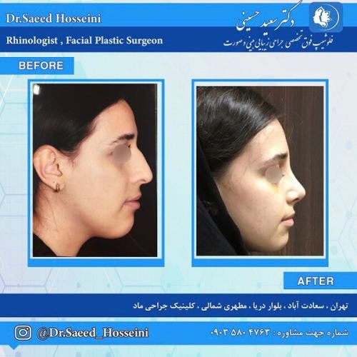 جراحی-بینی288