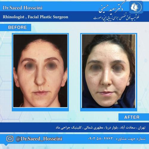 جراحی-بینی291