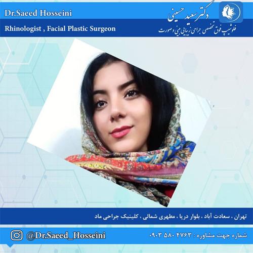 جراحی-بینی-175