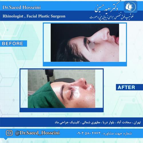 جراحی-بینی-247