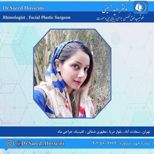 جراحی-بینی-248