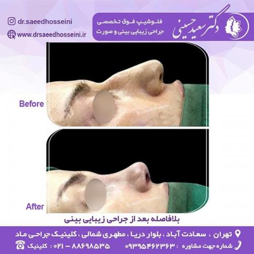 جرای-زیبایی-بینی-106