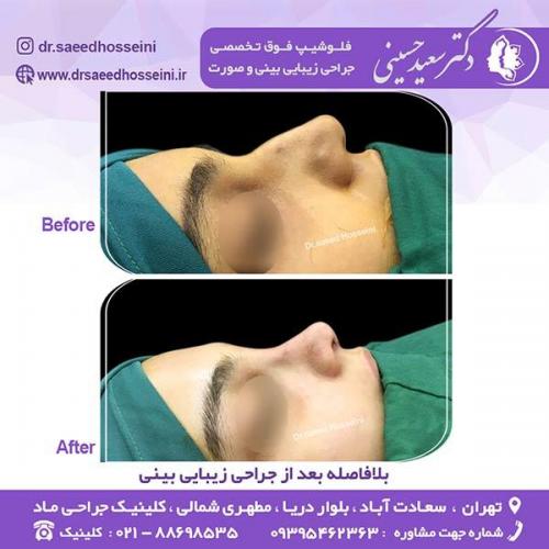 جرای-زیبایی-بینی-136